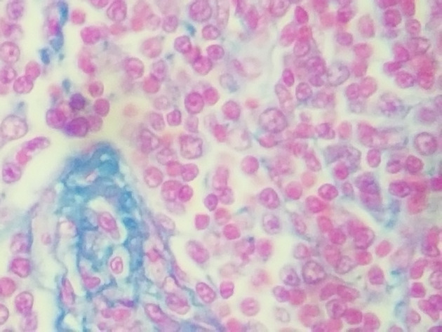Reticular Connective Slides - Reticular Connective 14 400X